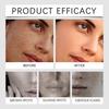 Dark Spot Corrector Serum Reduce Sun Spots & Age Spots Anti-Hyperpigmentation for Face & Body