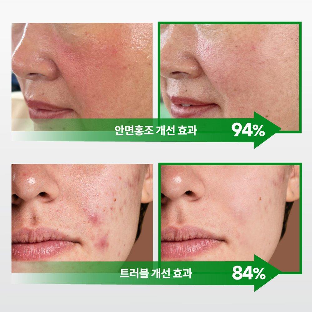 Маска Viewdiani Cica Ampoule 100 подушечек / 150 мл