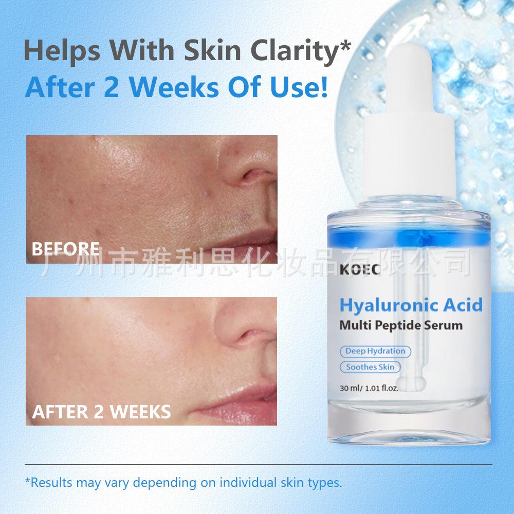 KOEC Peptide HA Facial Moisturizing Serum Hyaluronic Acid Soothing Hydrating Essence Anti-Wrinkle Serum less