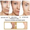3pcs Turmeric Skin Glow Face Serum Dark Spot Whitening Black Patches Melasma Corrector Brightening Anti-aging Skin Care