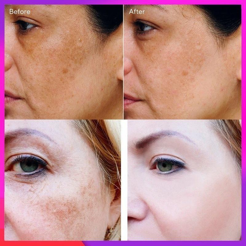 Новейший отбеливающий крем для лица с витамином С, ремонт, выцветание веснушек, удаление темных пятен, средство для удаления меланина, осветляющий крем для лица