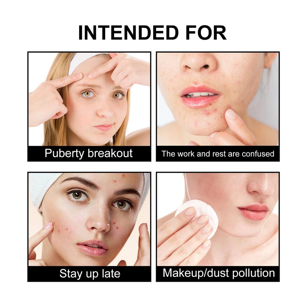 Cute Black Acne Patches For Face,Reduce Acne, Close Acne Marks, And Remove Blackheads(108 Count)