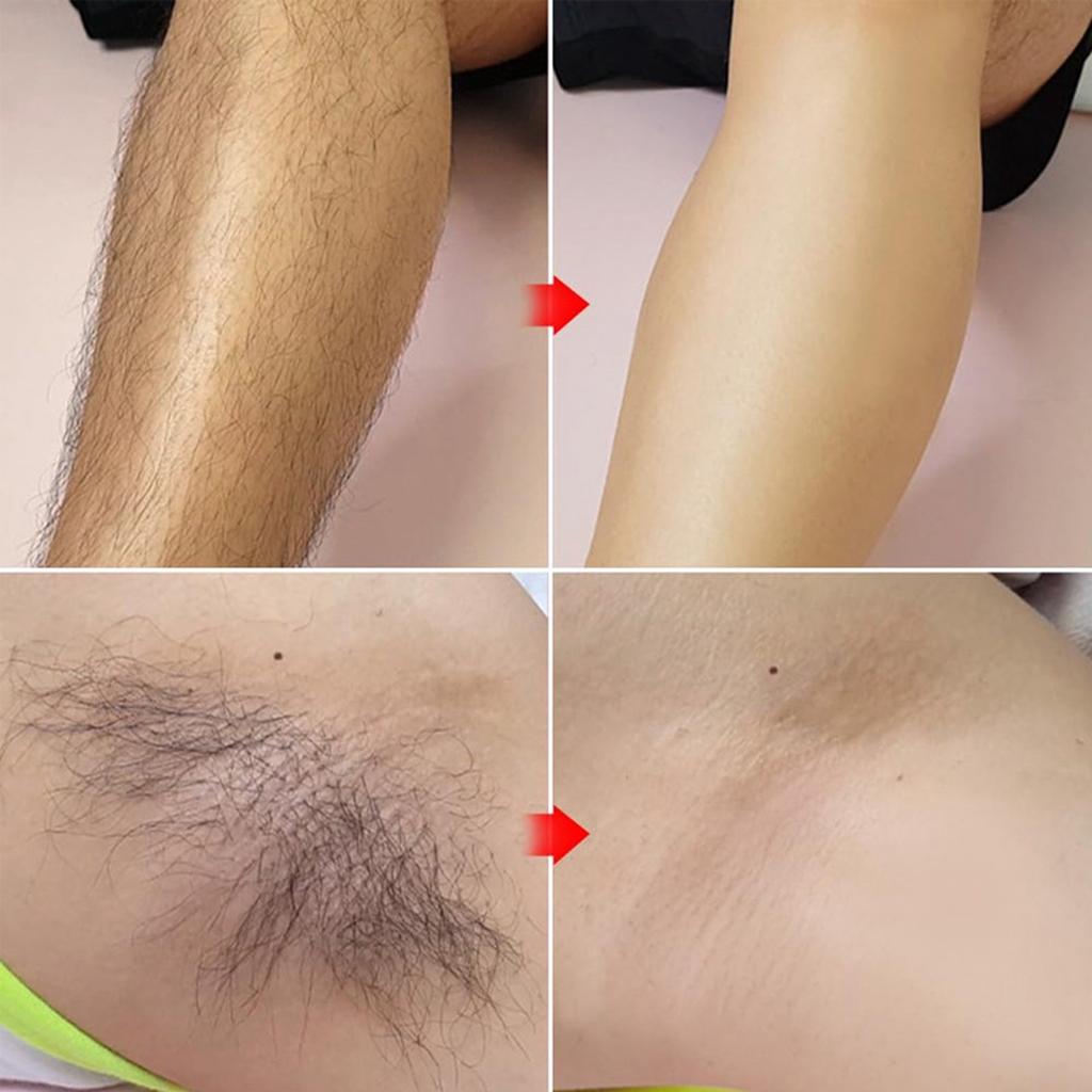 Паста для депиляции волос для мужчин и женщин, паста для депиляции, благоприятная для кожи, быстрый и эффективный лосьон для удаления волос на теле для всех типов кожи