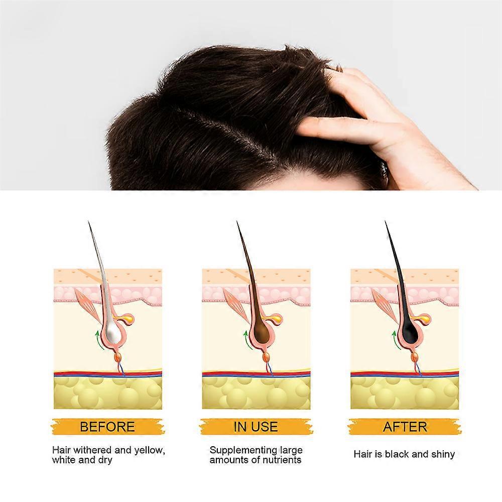 4PCS Men's Grey Coverage Bar Shampoo Hair Darkening Black Soap for Grey Hair Cover