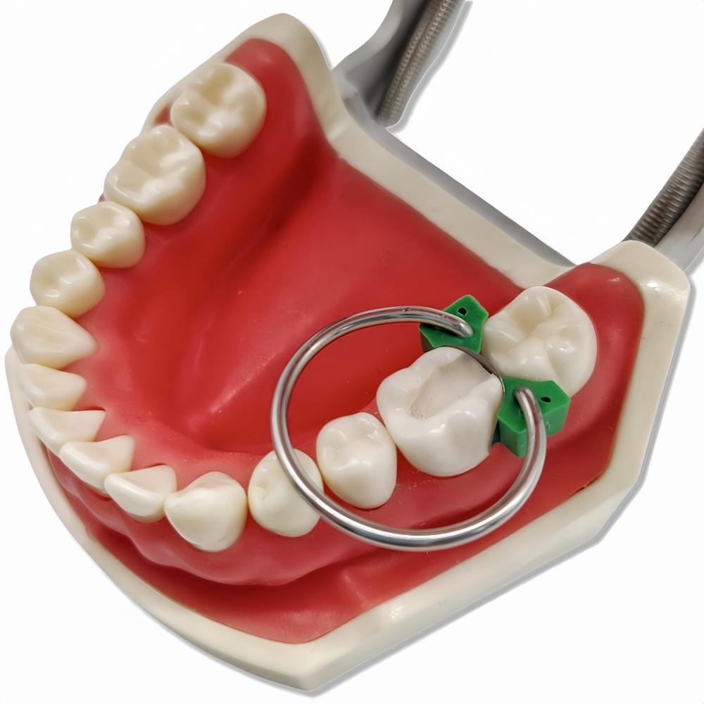100 шт./компл. стоматологические ортодонтические секционные контурные матрицы набор матриц стоматологические пластиковые клинья резиновые клинья ортопедический материал матрицы