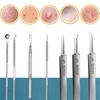 1set Face Blemish Blackhead Removal Tools Acne Needle +10x Makeup Magnifying Mirror Skin Care Squeezing Pimples Auxiliary Tools