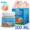 Sumifun 20/40/100 ML Toenail Correction Repair Ointment Relieve Nail Fungus Infected Brightening Soft Nails Health Nourish Moisturize Cream