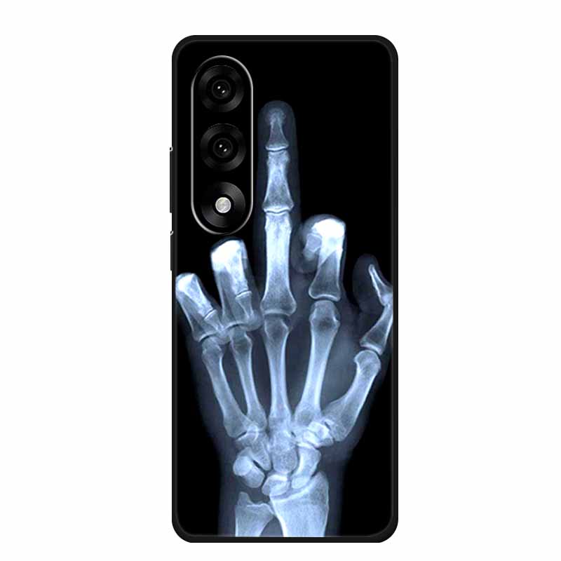 For OnePlus Nord 5 5G Case Nord5 Phone Cover Wolf Lion Black Silicone Soft Back Cover For OnePlus Ace 5 Ultra Case 6.83" Coque