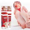 20g Bunion Cream for Pain Relief Effective Comforting Joint Pain Cream for External Use
