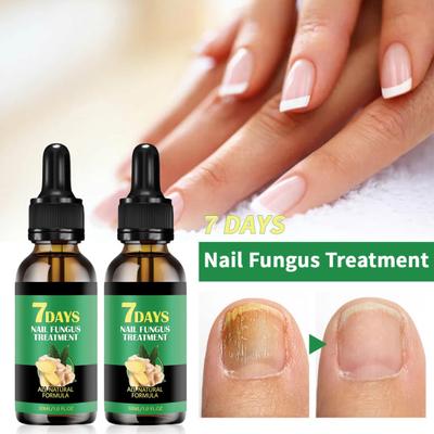 30 мл Сыворотка для роста ногтей Имбирь Лечение ногтей Восстановление роста ногтей Эфирные масла Натуральное безопасное масло для ухода за кутикулой для ногтей Увлажнение Укрепление