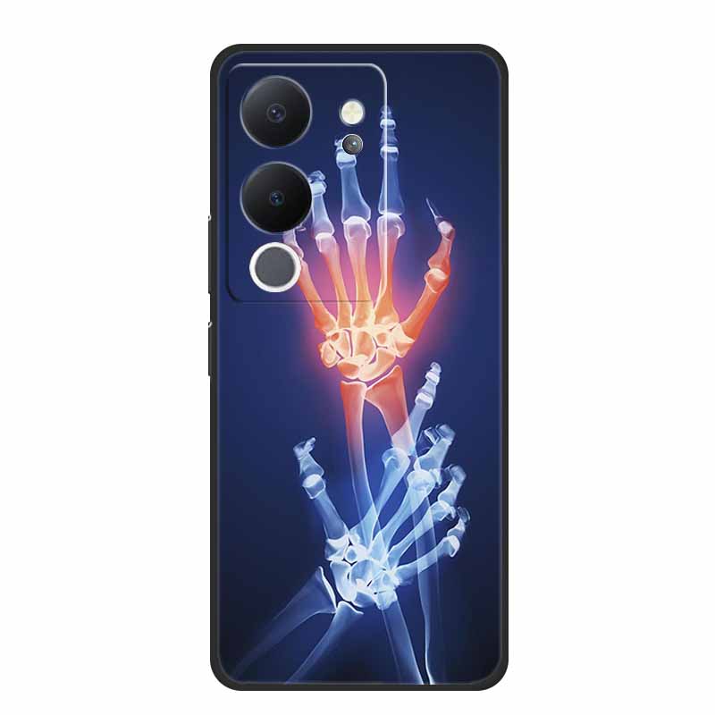 6.67" Чехол для Vivo V30 Lite Черный Силикон Мягкие Чехлы для Телефона Для Vivo V30 Lite Задняя Крышка Чехол V 30 Lite Funda Coque Оболочка Capas