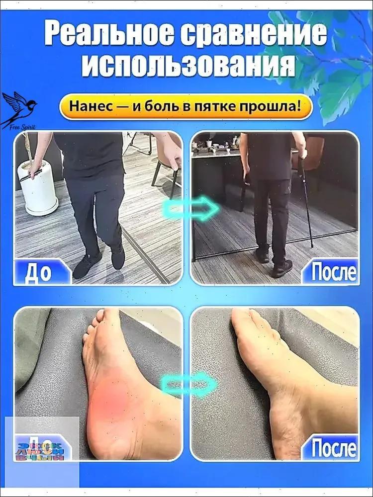 Медицинская желчь для пяточных шпор, жидкая, 51 г