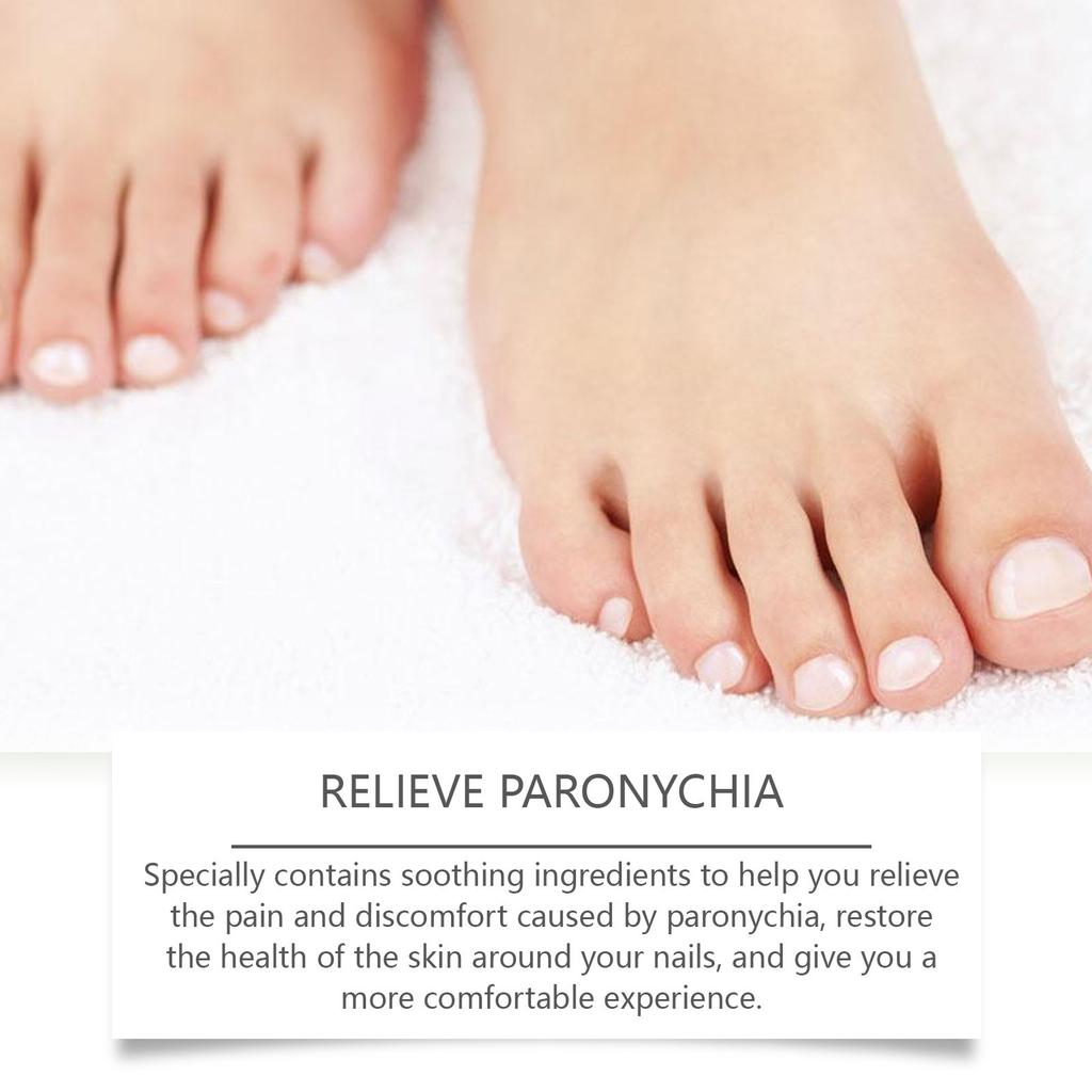 Масло для роста ногтей Leuconychia Масло для ногтей Mycosis Care For Nail Mycosis Foot Mycosis Red Brown Foot 30ML