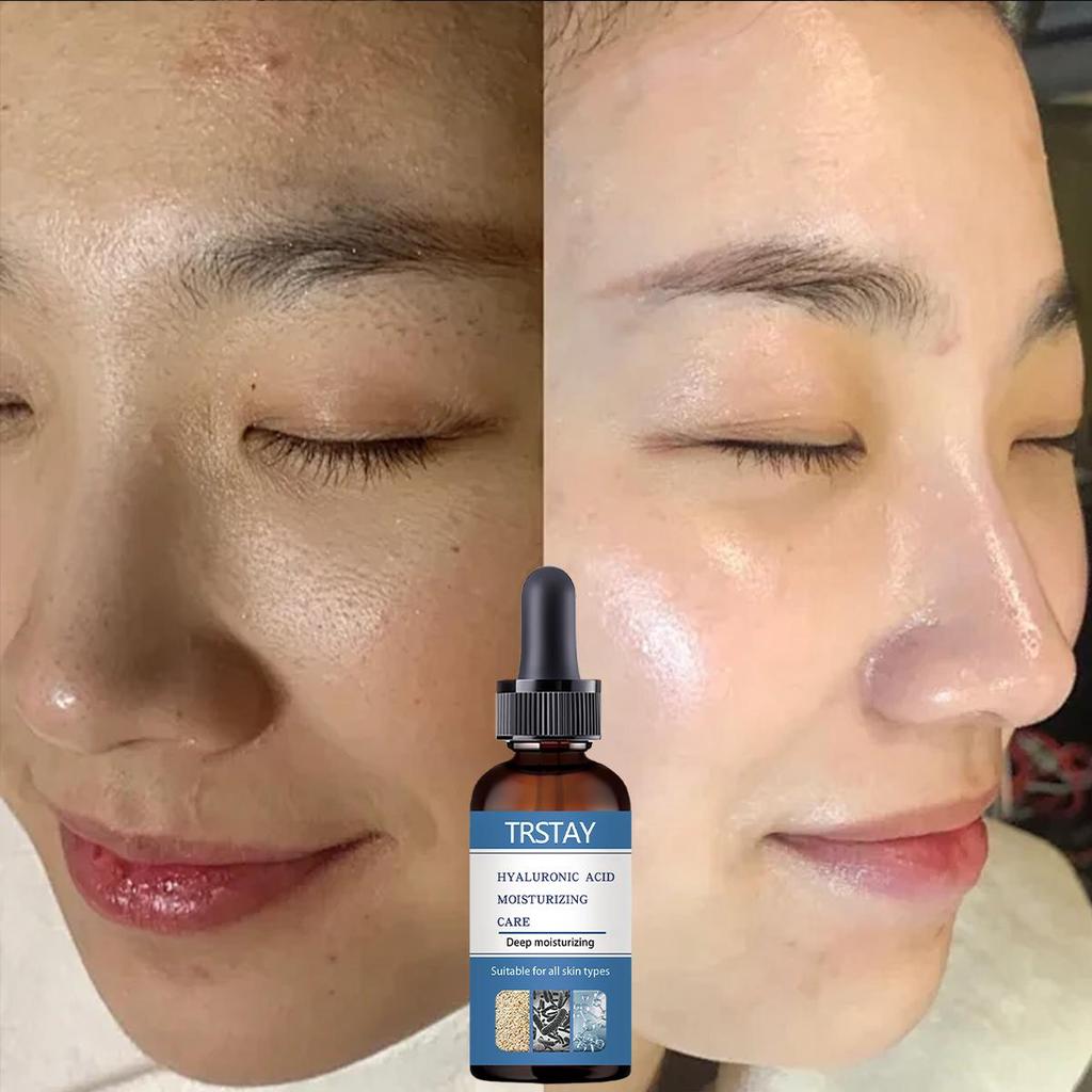 TRSTAY Nicotinamide Essence Can Remove Black Spots, Whiten And Brighten Pores, Shrink Hyaluronic Acid Collagen, And Protect The Face