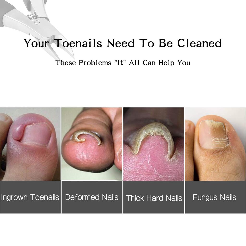 Ingrown Toenail Clippers or Thick Toenails Sturdy Toe Nail Clippers Leather Packaging for Safe Storage Easily Maintain Healthy Nails - + -