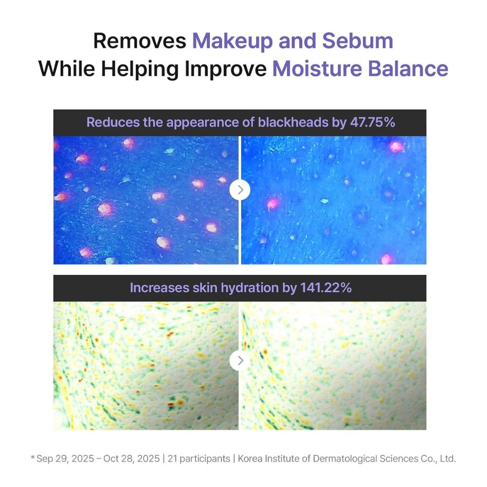 Rejuran Derma Healer Очищающий бальзам для сужения пор 50 мл / 1,69 жидк. унц.. унция