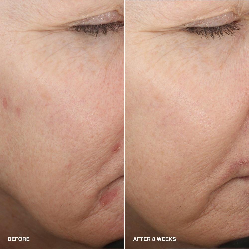 Bobbi Brown Витаминная обогащенная разглаживающая сыворотка с ниацинамидом 1,01 унции