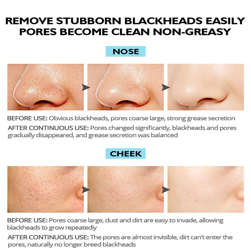Маска для удаления черных точек – отшелушивающая маска для лица для глубокого очищения пор с бамбуковым углем, грязью и глиной