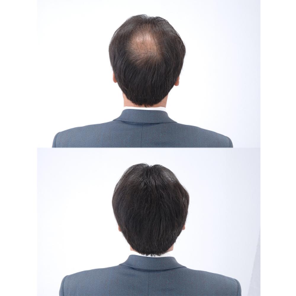 Super Million Hair Super Million Hair Портативный набор Дорожный Переносимый Спрей Черный Цвет Не Забивает Поры