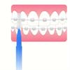 Межзубная щетка в виде карандаша Oral Interdental Brush I-образная прямая скоба межзубная щетка 30 шт./коробка