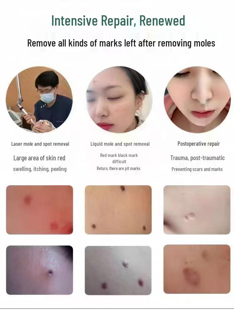 Восстанавливающий крем от солнечных ожогов, веснушек и родинок - Питает, уменьшает покраснение и отечность, успокаивает кожу - Эксклюзив для салонов