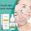 Капли для лечения акне Осветляющие прыщи Угри Угри Закрытый рот Очищающая эссенция для пор кожи лица