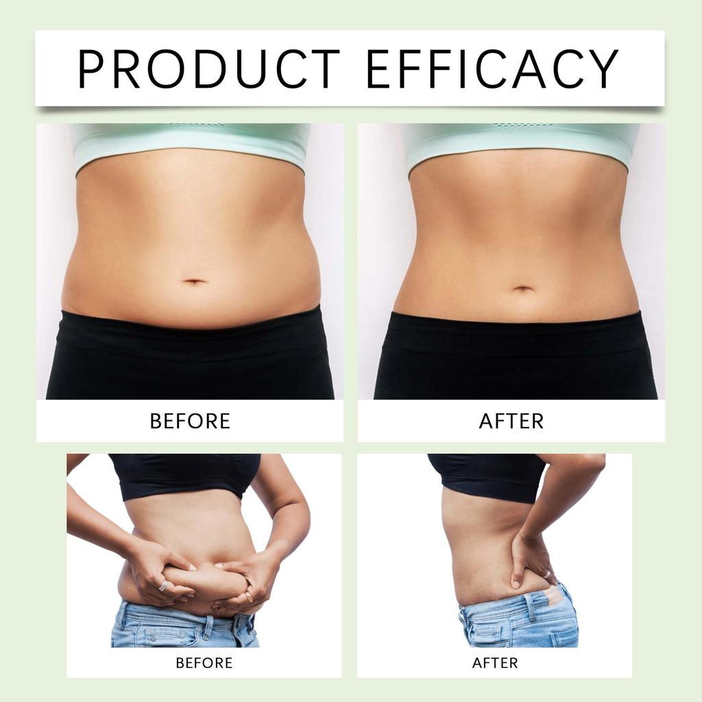 30 г Крем для лечения полыни Растительные экстракты Мягкие ингредиенты Ухаживающий за кожей Аппликатор для тела