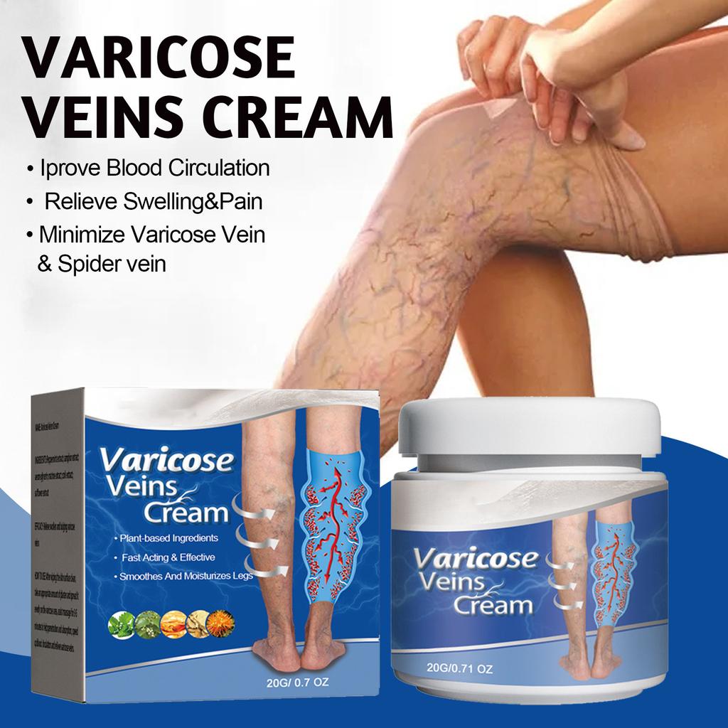 Varicose and Spider Veins Ease for Legs, Improve Blood Circulatio