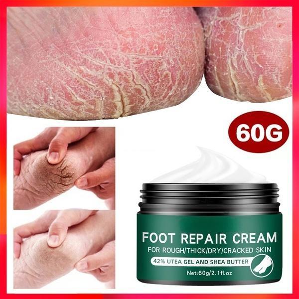 Новейший восстанавливающий увлажняющий крем для кожи рук и ног, против растрескивания, для грубых, сухих и потрескавшихся ног, крем для восстановления пяток