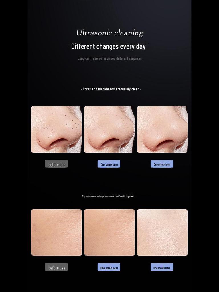 Ультразвуковой скребок для удаления черных точек - очиститель лица и средство для удаления прыщей с вибрацией для очистки пор и гладкой кожи