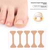 I-shaped Positive Nail Sticker Nail Groove Inner Roll Stretching Glue-free Inlaid Nail Toe Pad Nail Orthopedic Patch