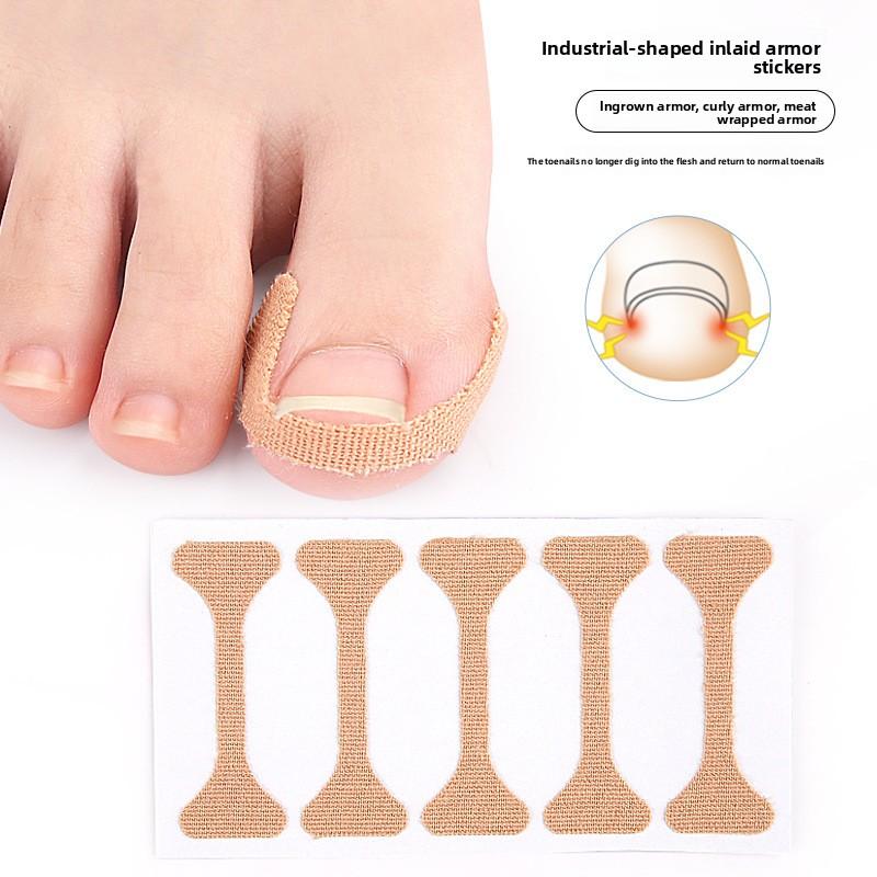 I-shaped Positive Nail Sticker Nail Groove Inner Roll Stretching Glue-free Inlaid Nail Toe Pad Nail Orthopedic Patch