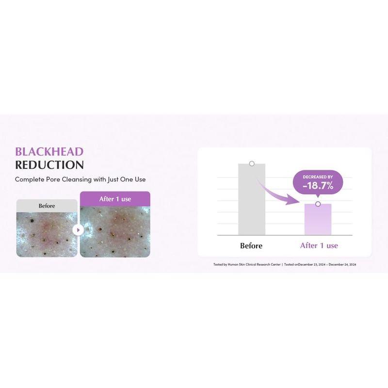 Eqqualberry Очищающее средство-маска для пор с фиолетовым рисом