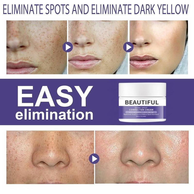 Moisturizing, Moisturizing and Freckle Removing Skin Care Cream