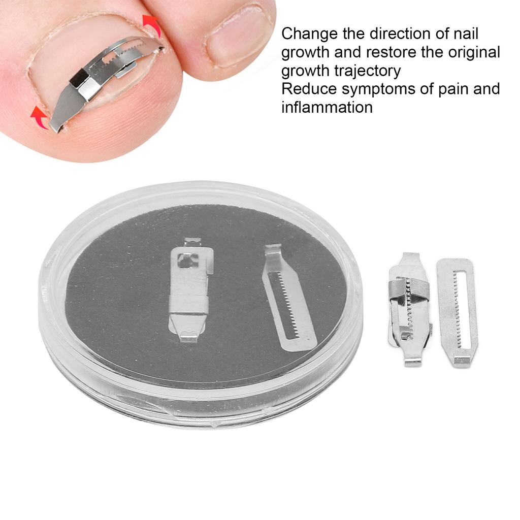2PCS Ingrown Toenail Corrector Stainless Steel Paronychia Correction Tool for Toenail Correction