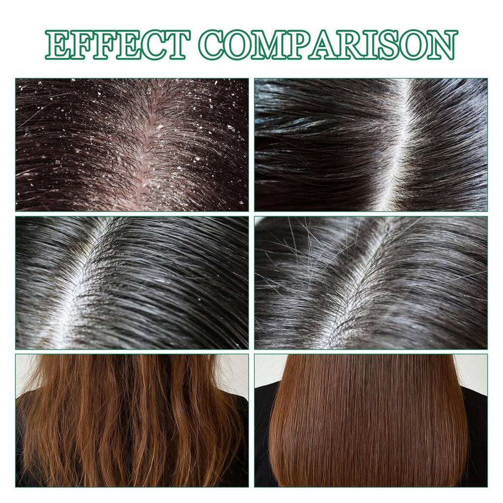 Nourishing Shampoo, Refreshing Shampoo, Gently Nourishes The Scalp, Strengthens Hair Quality And Promotes Hair Growth,250ml