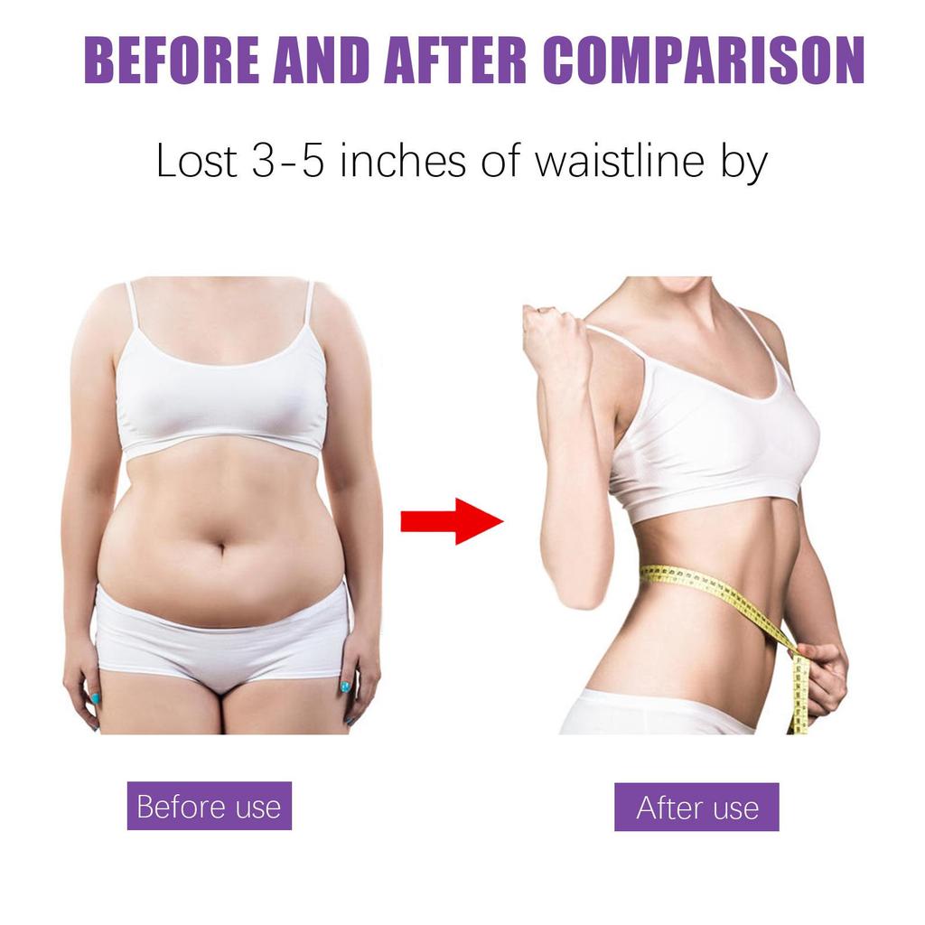 Cellulite Cream, Gentle and Non-irritating, Firms the Skin, Brightens the Complexion, and Leaves the Skin Soft and Delicate