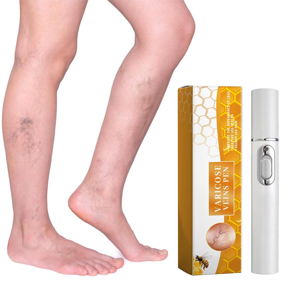 Ручка для лечения варикозного расширения вен Ручка для снятия дискомфорта при вздутии ног Ручка для расслабления ног Ручка для абажурной терапии Ручка для восстановления ног