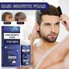 3pcs Regaine For Men Hair Loss Regrowth Scalp Foam - Extra Strength-yvan