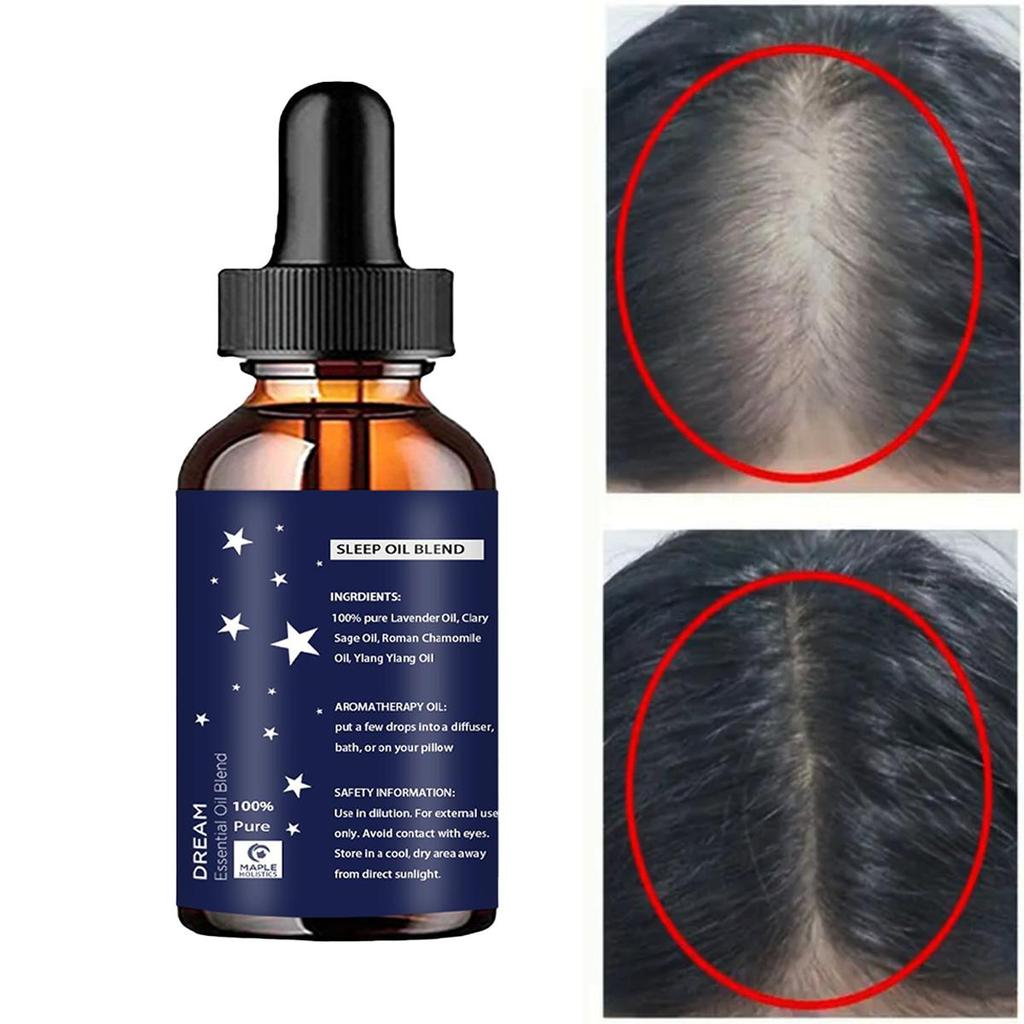 Натуральное эфирное масло для быстрого роста волос, средство против выпадения волос, эссенция для роста волос, лечение алопеции для женщин