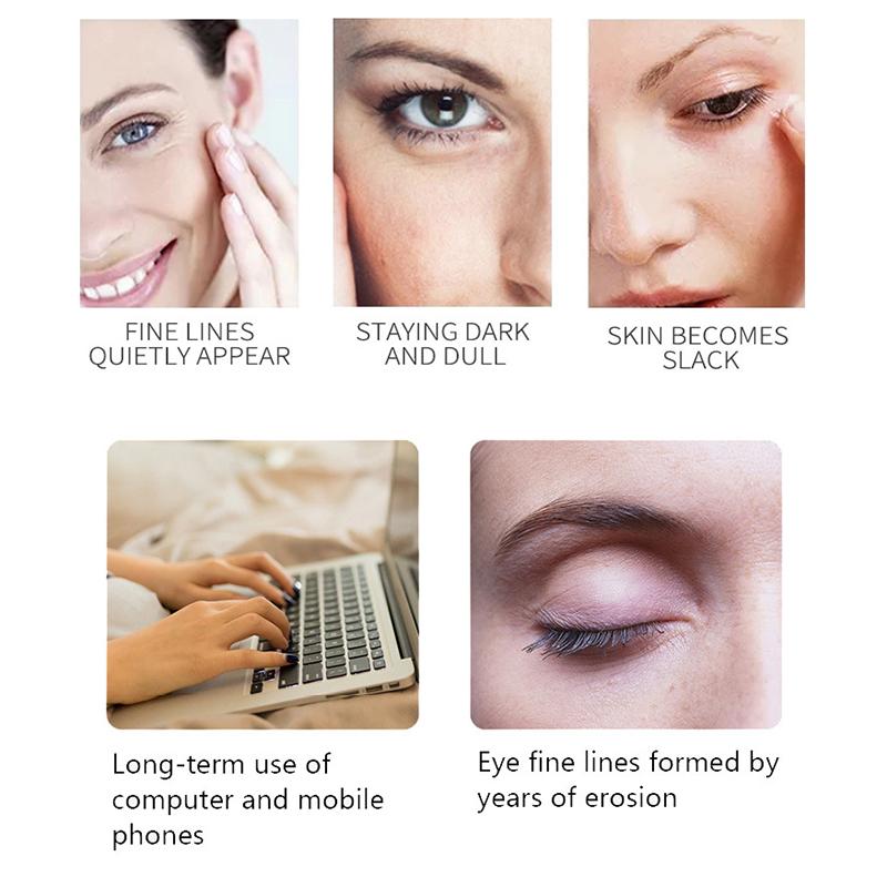 Уход за глазами Не ложиться спать поздно Успокаивающий укрепляющий крем для глаз Светлые темные круги под глазами Мешок под глазами Массаж Электрический крем для глаз