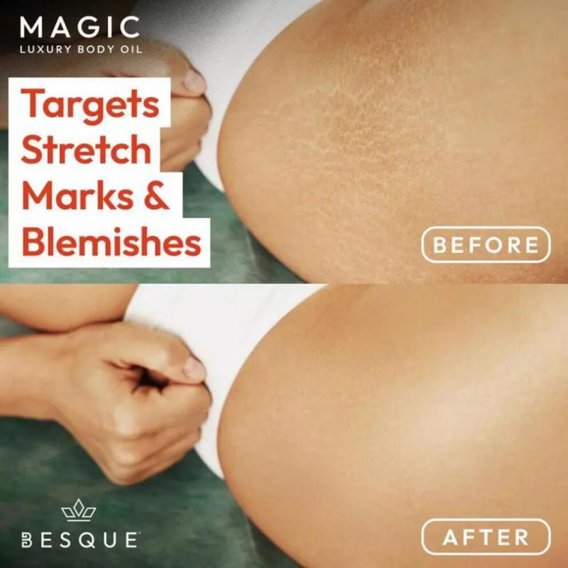 3pcs  100ml Magic Body Oil - Firms, Tightens & Hydrates Sagging Skin (Full-Body Use; Arms, Chest, Thighs & Tummy)