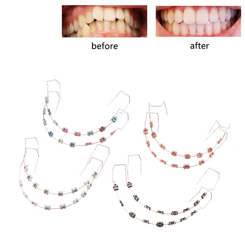 1 пара цветных временных украшений для зубов с металлической проволокой, металлическими скобками и ортодонтической лигатурой, украшения для зубов
