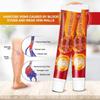 2pcs Health Cream For Relieving Varicose Veins, External Ointment For Vasculitis, Blood Circulation, Varicose Veins