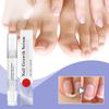 Сыворотка для роста ногтей, уход за ногтями от грибка, ручка для восстановления здорового вида ногтей, обесцвеченных или поврежденных грибком ногтей, 3 мл