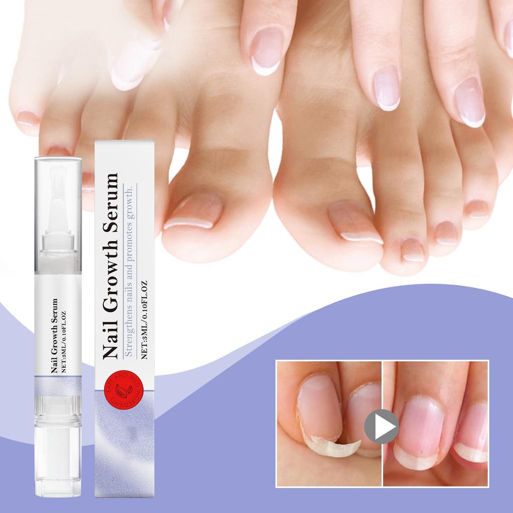 Сыворотка для роста ногтей, уход за ногтями от грибка, ручка для восстановления здорового вида ногтей, обесцвеченных или поврежденных грибком ногтей, 3 мл