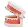Зубоврачебная ортодонтическая модель зубов с учебным оборудованием школы металлических брекетов