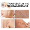 Самоклеящаяся лента для лечения рубцов, многоразовые пластыри для ухода за рубцами, для покрытия пятен на теле и шрамов