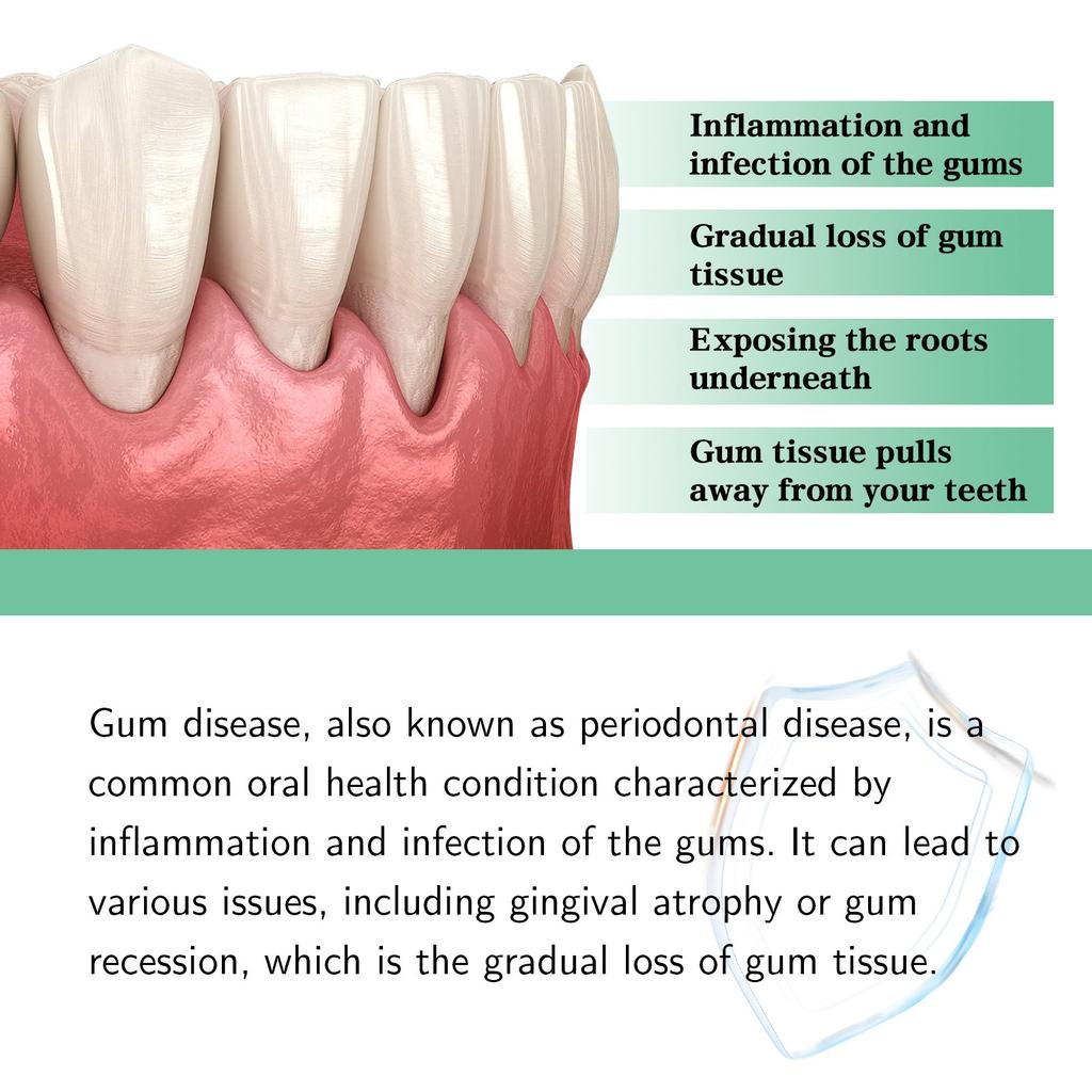 DentiZen капли для восстановления роста десен, масло для полоскания зубов и десен, легкое омоложение десен, 30 мл