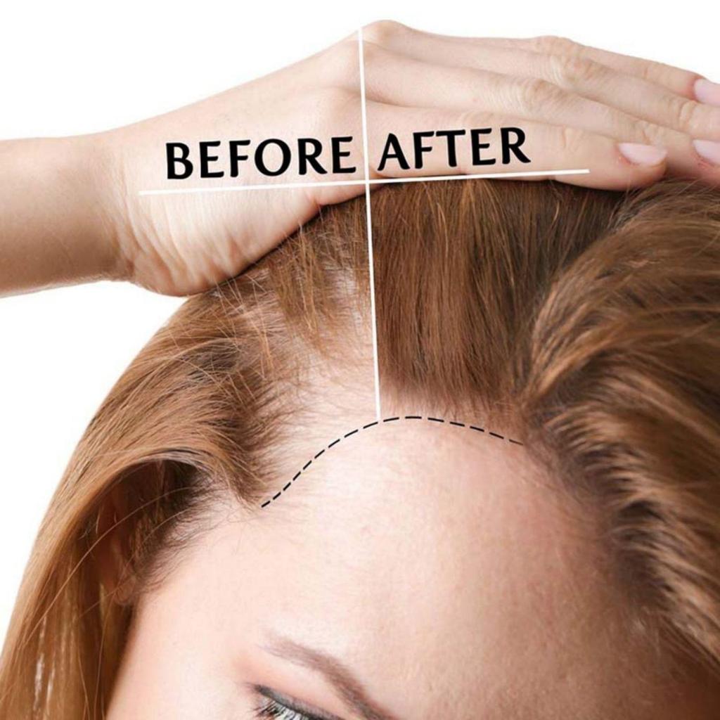 5 мл/15 мл/30 мл/50 мл/сыворотка для роста волос продукт по уходу за волосами сыворотка для волос быстрые волосы